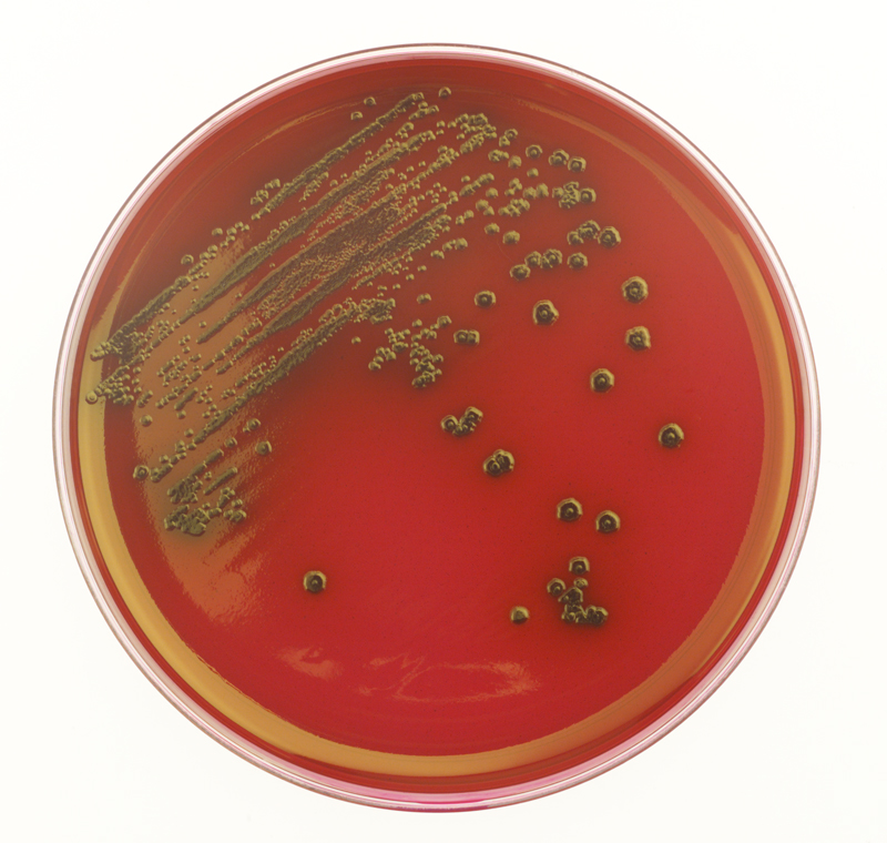 Methods For Growth Success: Aerobic Microorganisms – Microbiologics Blog