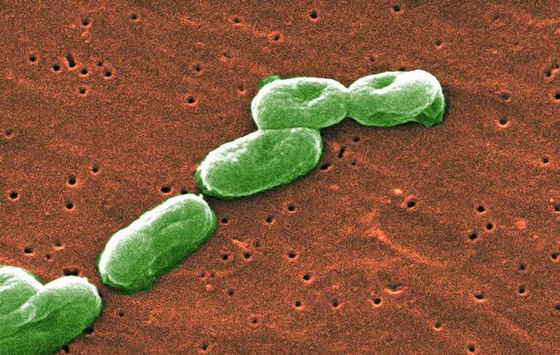 Environmental Isolate Case Files: Burkholderia cepacia complex