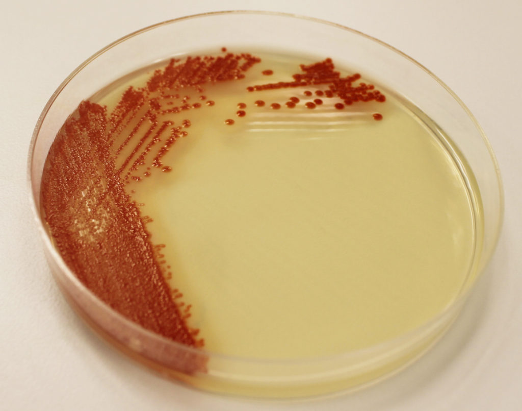 environmental-isolate-case-files-serratia-marcescens-microbiologics-blog