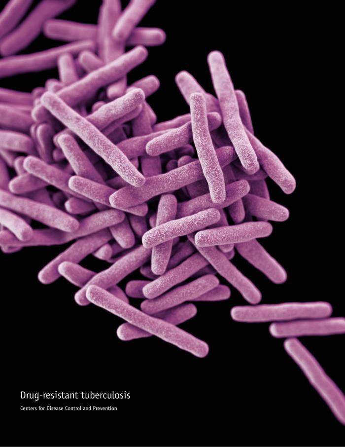 Drug Resistant TB_CDC