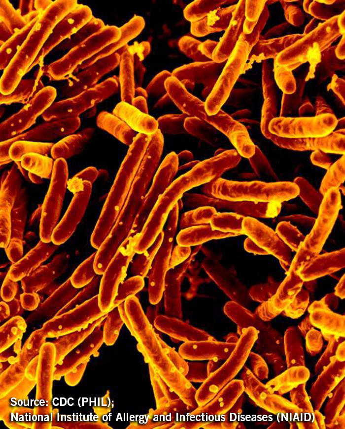 The Battle with Tuberculosis Rages On