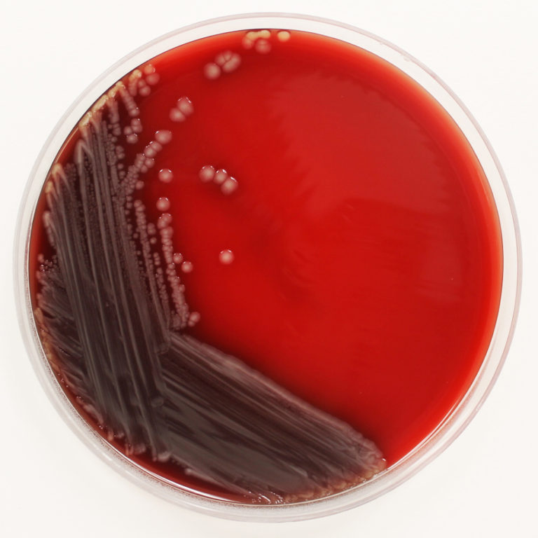 The Who’s Who of E. coli Strains – Microbiologics Blog