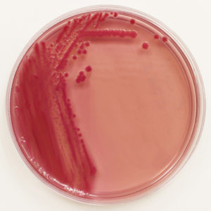 The Who's Who of E. coli Strains - Microbiologics Blog