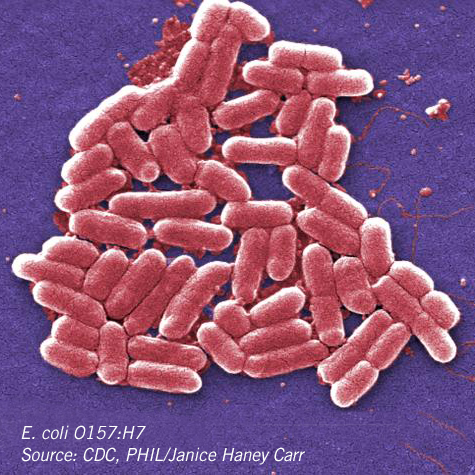 The Who's Who of E. coli Strains – Microbiologics Blog