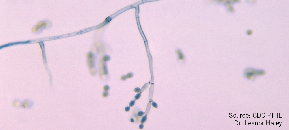 Environmental Isolate Case File: Cladosporium cladosporioides