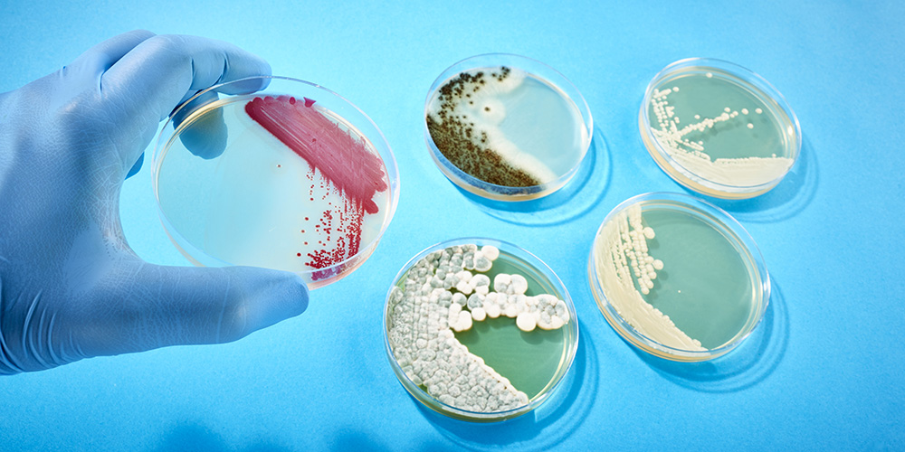 5 Reasons to Avoid Maintaining Stock Cultures in Your Lab