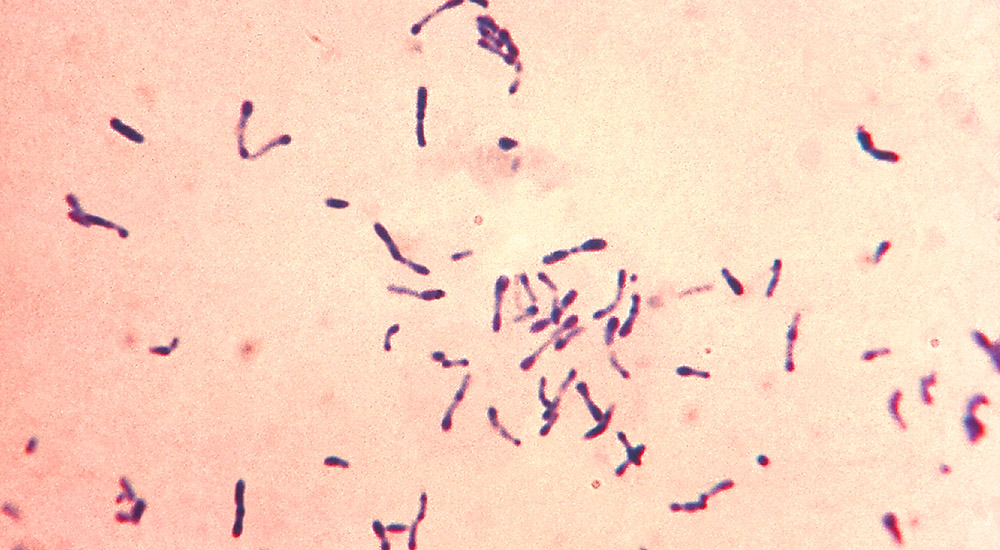 Environmental Isolate Case File: Corynebacterium spp.