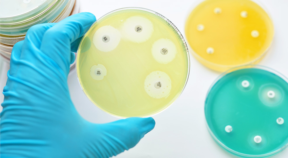 Antimicrobial Susceptibility Testing