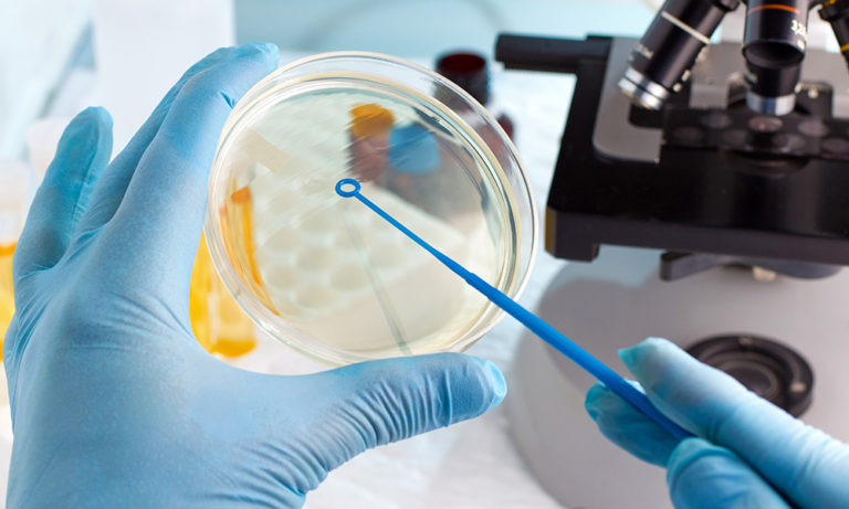 7-streak-plate-method-best-practices-microbiologics-blog