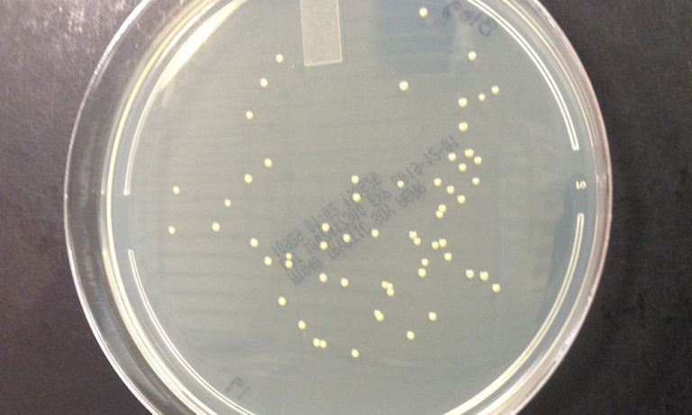 8 Aerobic Plate Count Best Practices Microbiologics Blog 8-aerobic-plate-count-best-practices-microbiologics-blog