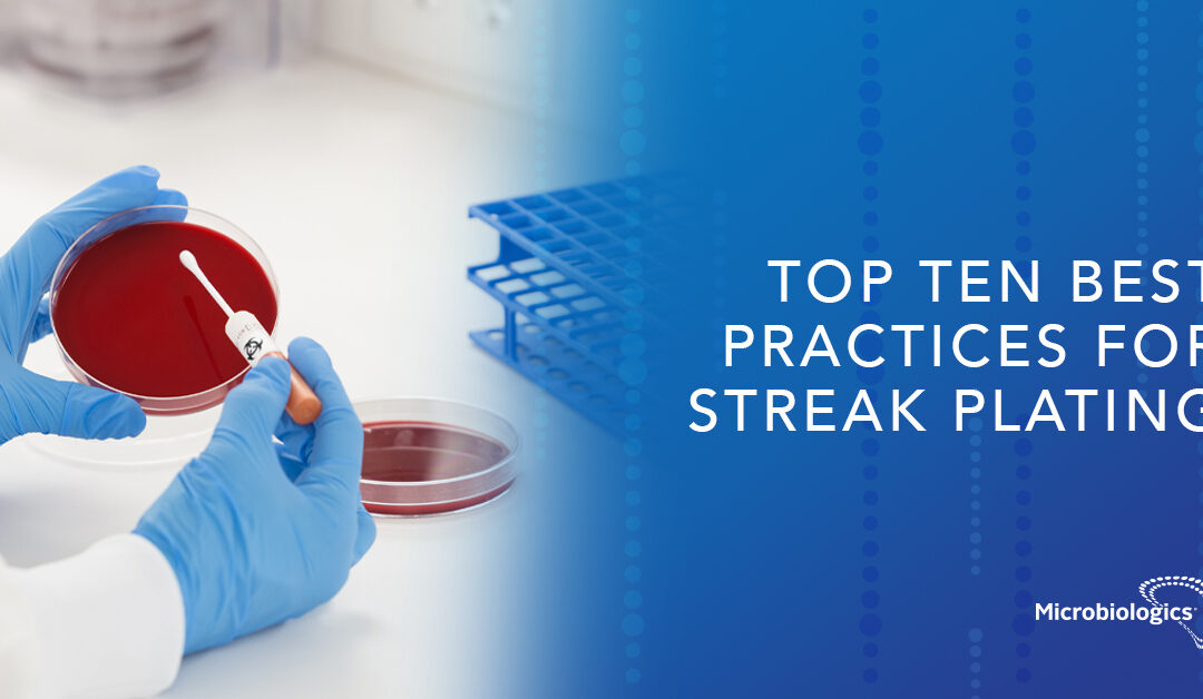 Top Ten Best Practices for Streak Plating