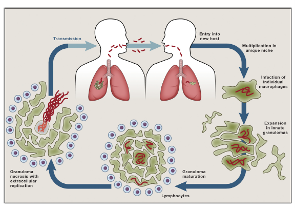 Tuberculosis infection