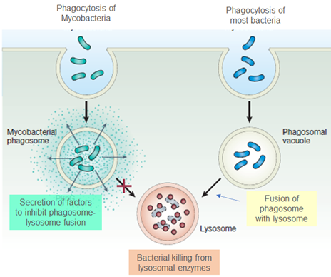 Tuberculosis Infection