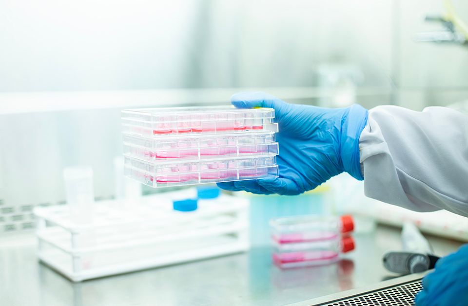 Adventitious Agent Screening